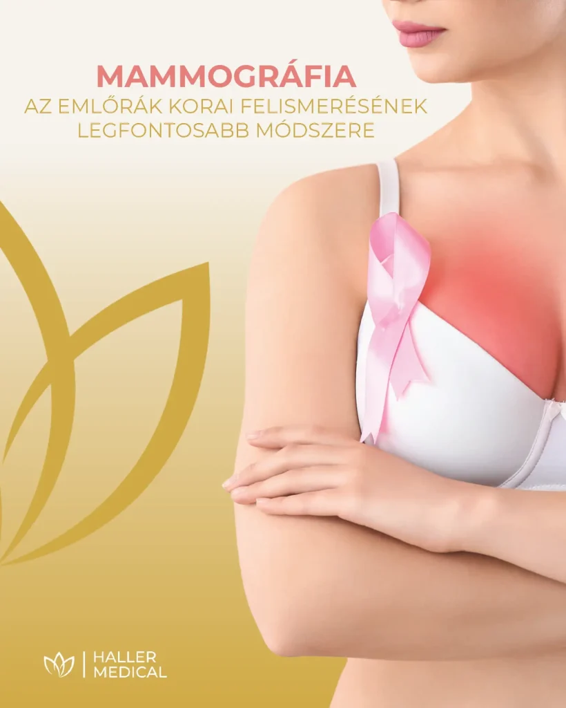 A mammográfia az emlőrák korai felismerésének legfontosabb módszere e-könyv borítója